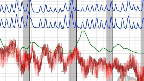 Cardiograph