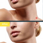 photo retouch object removal للاندرويد